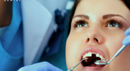 La pérdida de dientes por golpes puede evitarse, si se actúa a tiempo, especialistas de La Clínica Dental
