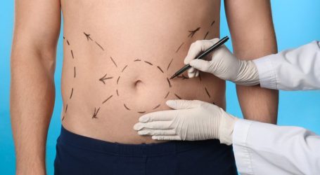 Abdominoplastia y sus beneficios de acuerdo al Dr. Carlos Nuñez